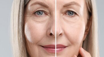 Anti-rides, anti-taches : le nombre EXACT de jours à attendre avant de juger un soin inefficace