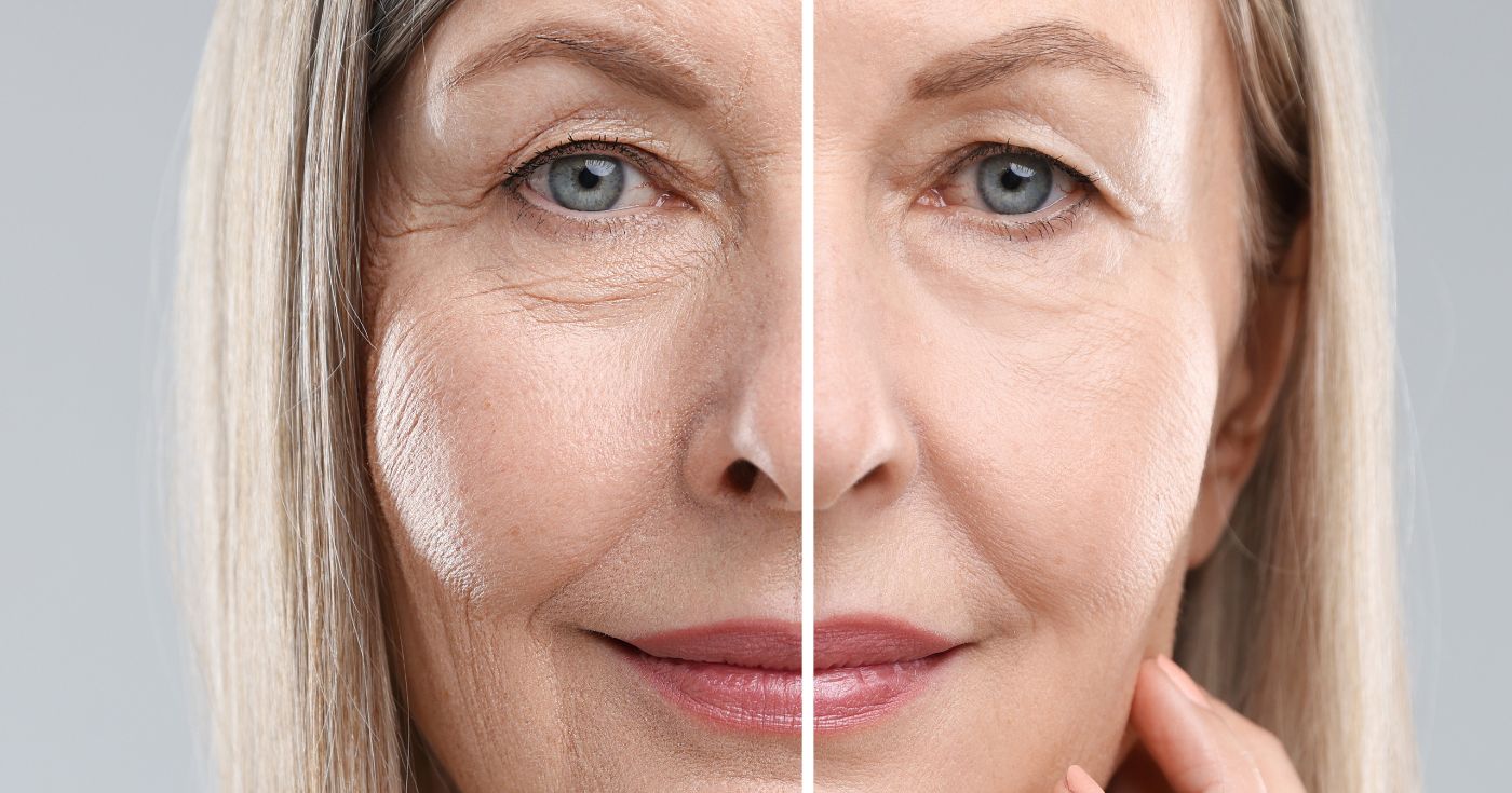 Anti-rides, anti-taches : le nombre EXACT de jours à attendre avant de juger un soin inefficace