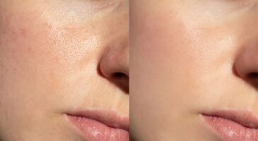 Pores dilatés, brillance sur la zone T : vous regretterez de ne pas avoir essayés plus tôt ces 5 soins très bien notés par la communauté