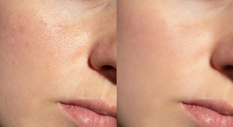 Pores dilatés, brillance sur la zone T : vous regretterez de ne pas avoir essayés plus tôt ces 5 soins très bien notés par la communauté