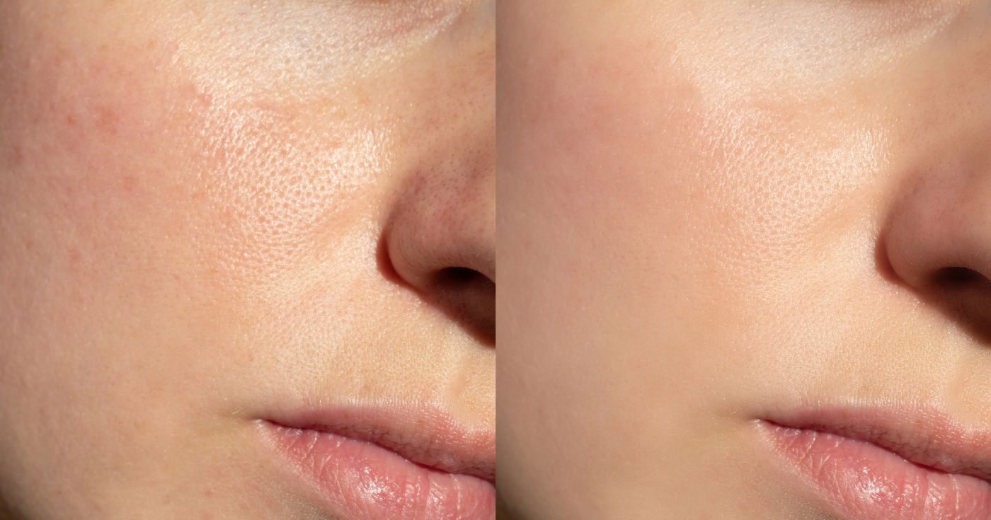 Pores dilatés, brillance sur la zone T : vous regretterez de ne pas avoir essayés plus tôt ces 5 soins très bien notés par la communauté