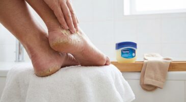Talons fissurés, pieds secs qui accrochent : ce traitement de nuit recommandé par les spécialistes transforme la peau en une nuit