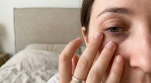 Vous avez des cernes malgré 8h de sommeil ? Cette médecin révèle la vraie cause (et ce qu&rsquo;il faut changer rapidement !)