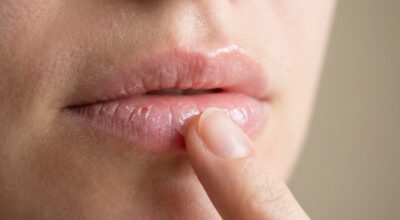 Ce rituel du soir m&rsquo;a permis de ne plus jamais avoir les lèvres gercées (et vous faites sûrement l&rsquo;erreur inverse)