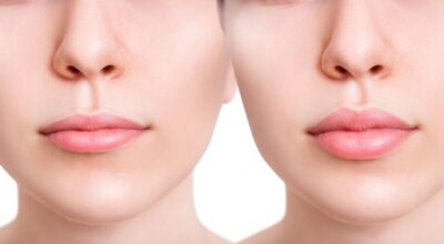 Oubliez les injections : pourquoi ce nouveau gloss est le secret anti-âge des lèvres affinées