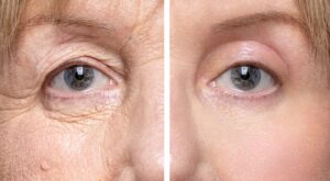 Paupières tombantes : l&rsquo;actif anti-âge puissant qu&rsquo;il faut absolument utiliser (et ce n&rsquo;est pas le rétinol !)