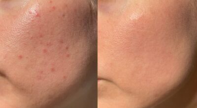 Ce produit teinté hydratant Hourglass donne un glow si crédible que j’ai arrêté le fond de teint du jour au lendemain pour de bon