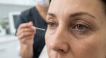 Nanofat anti-âge : ce traitement pour les cernes promet une peau régénérée, mais ces 5 points à vérifier avant de se lancer