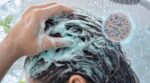 Canicule et pellicules : ce produit de grande surface apaise la tête et renforce le microbiome du cuir chevelu en quelques jours