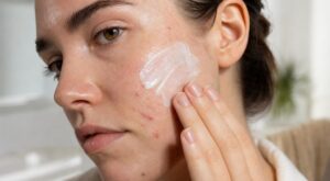 Cette protection visage SPF 50 non comédogène sauve les peaux à imperfections… sans déclencher ces boutons qui gâchent tout