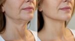 Lifting du visage : attention à ce geste qui change tout passé un certain âge, avec des prix et une durée que personne n’imagine
