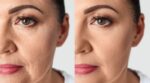 « Mon visage ne s'affaisse plus le matin » : cette crème anti-âge encensée sur Beauté Test améliore visiblement l'oval de votre visage